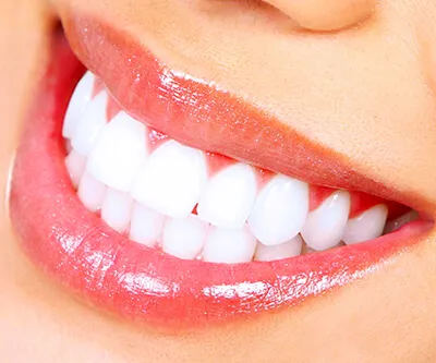 Dream Smile Center Teeth White